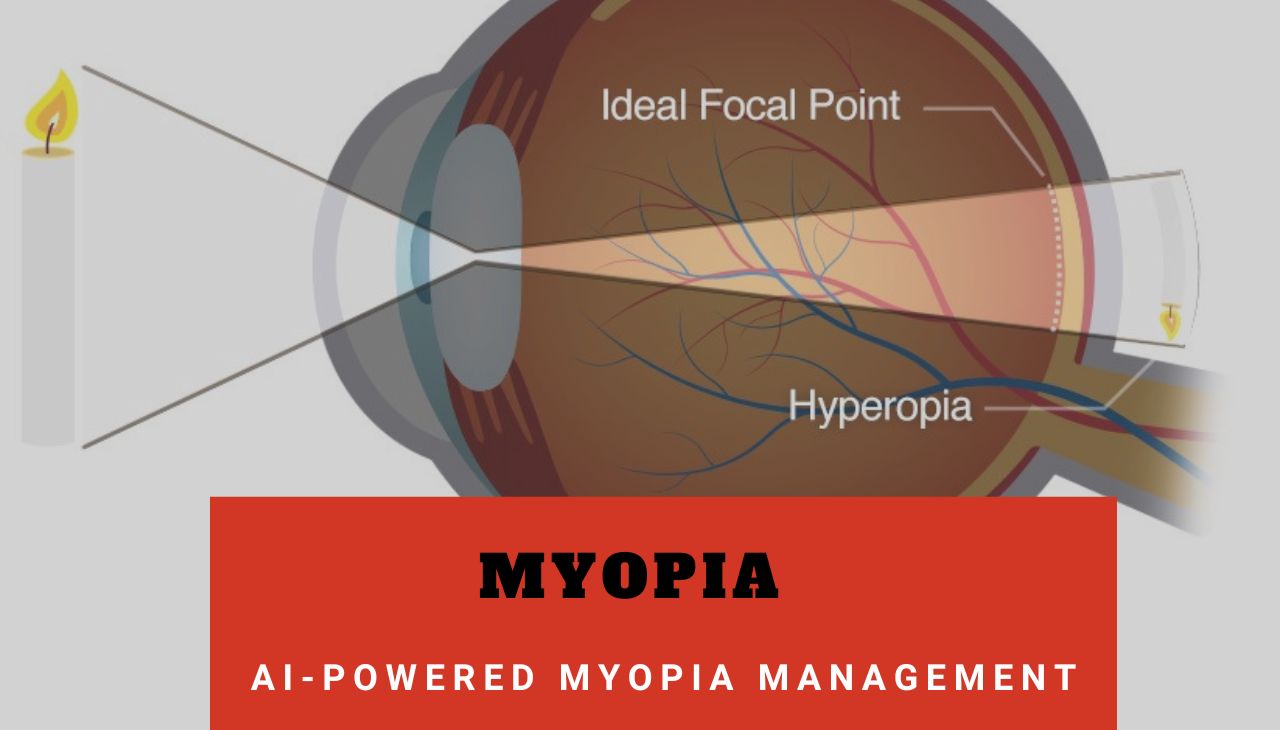 Hypermetropia: Everything You Need to Know About Farsightedness and Its Treatment