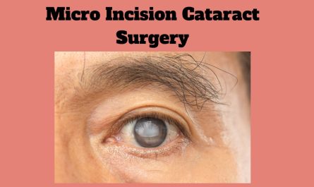 What is Micro Incision Cataract Surgery in Mumbai