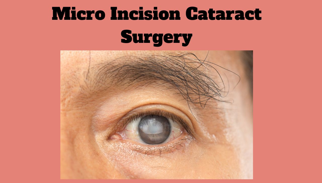 What is Micro Incision Cataract Surgery in Mumbai
