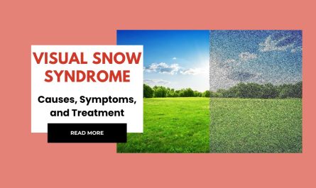 Visual Snow Syndrome: Causes, Symptoms, and Treatment Options