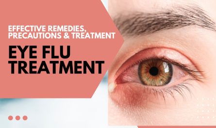 Eye Flu Treatment at Home: Effective Remedies, Precautions, and When to See a Doctor