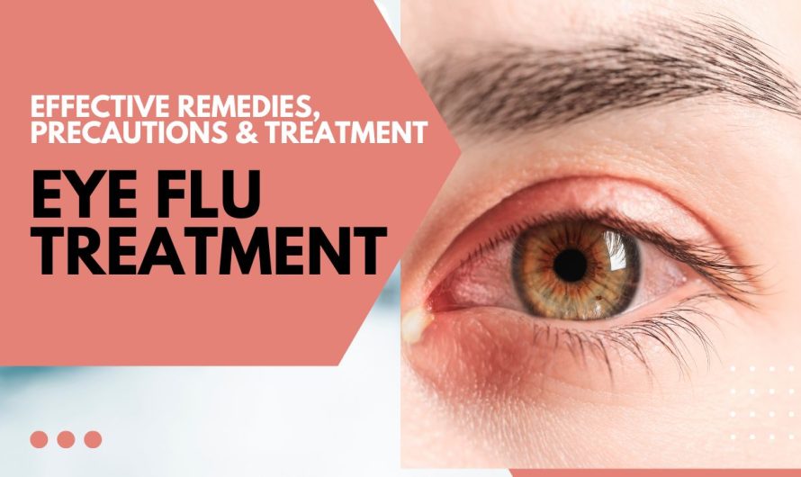 Eye Flu Treatment at Home: Effective Remedies, Precautions, and When to See a Doctor
