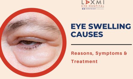 Eye Swelling Causes: Common Reasons, Symptoms & When to See a Doctor