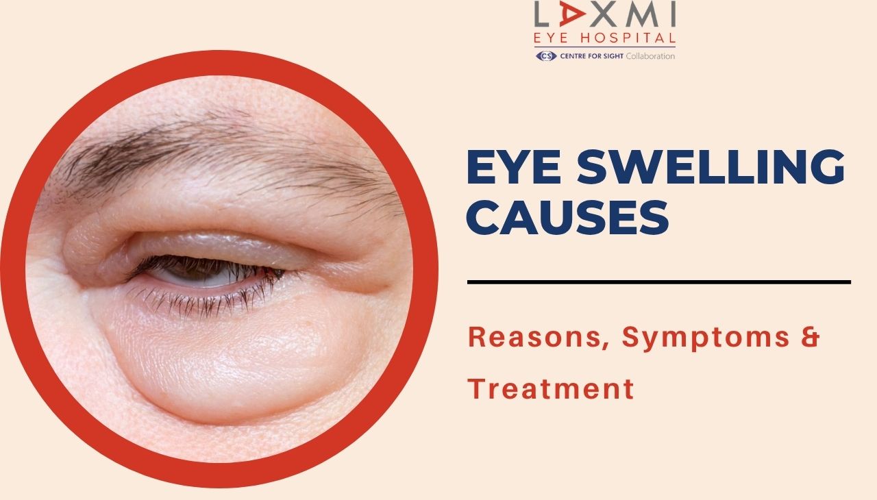 Eye Swelling Causes: Common Reasons, Symptoms & When to See a Doctor