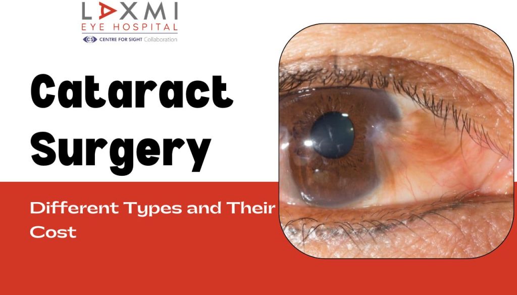 What Are the Different Types of Cataract Surgery and Their Cost ...