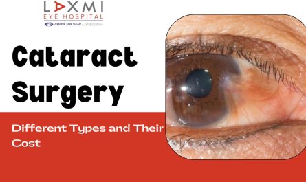 What Are the Different Types of Cataract Surgery and Their Cost?