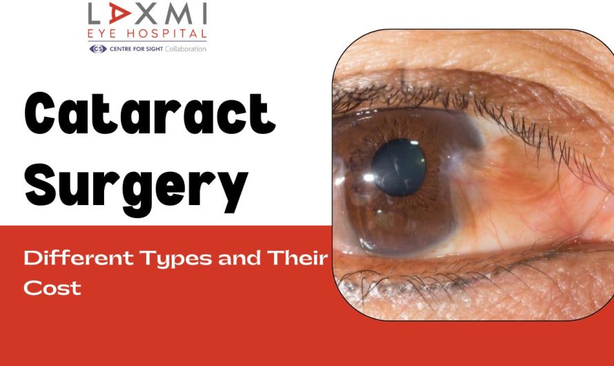 What Are the Different Types of Cataract Surgery and Their Cost?