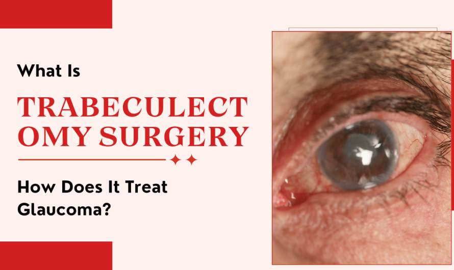What Is Trabeculectomy Surgery and How Does It Treat Glaucoma?
