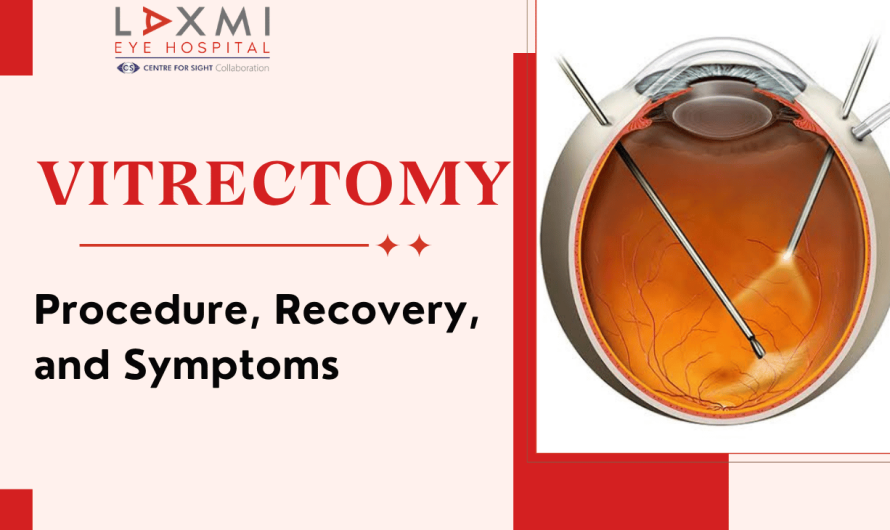 What is a Vitrectomy? Guide to Procedure, Recovery, and What to Expect