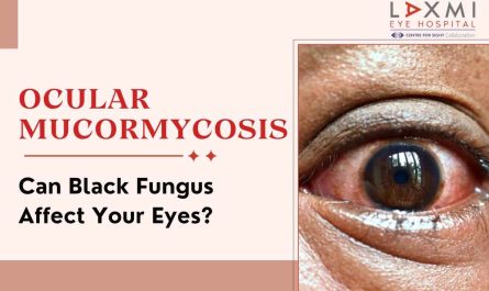 Ocular Mucormycosis treatment in mumbai