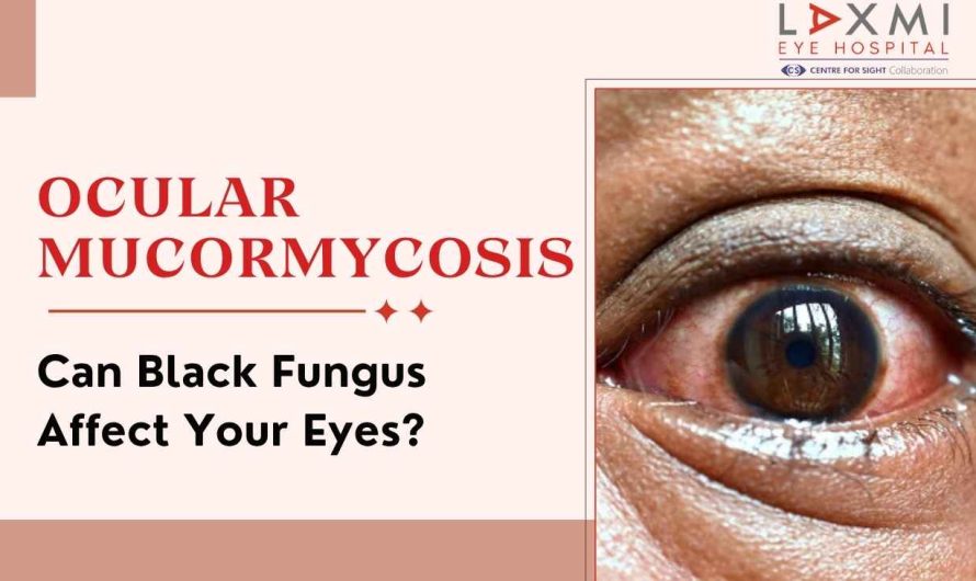 Can Black Fungus Affect Your Eyes? Understanding Ocular Mucormycosis
