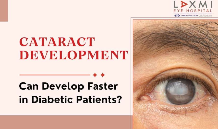 Can Cataract Develop Faster in Diabetic Patients?