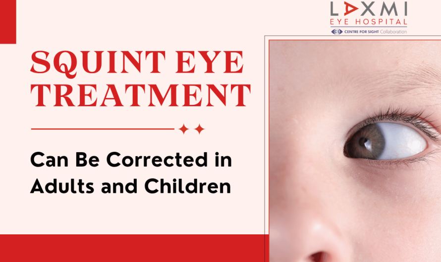 Squint Eye Treatment: Can Strabismus Be Corrected in Adults and Children