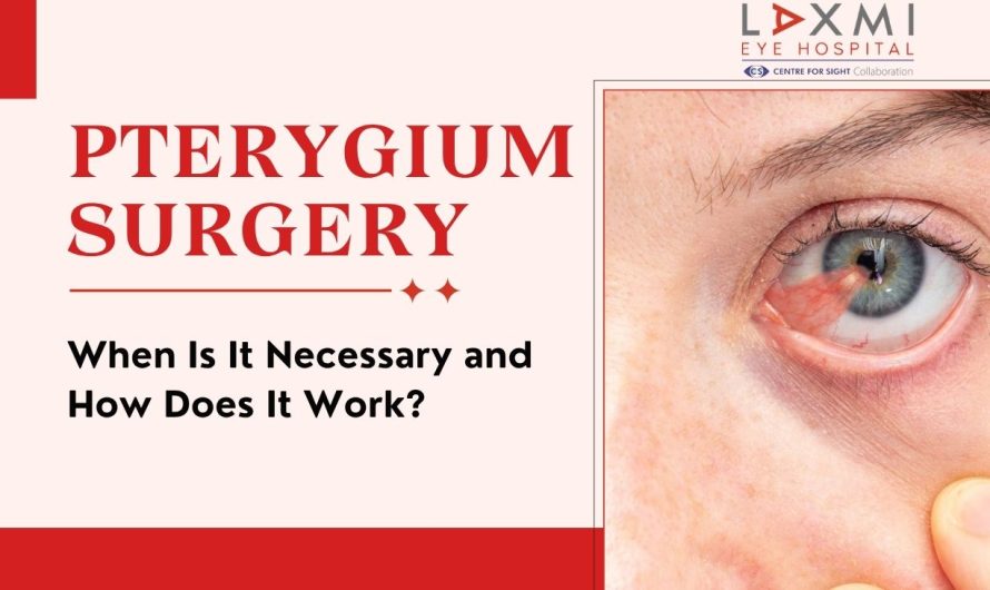 Pterygium Surgery: When Is It Necessary, and How Does It Work?