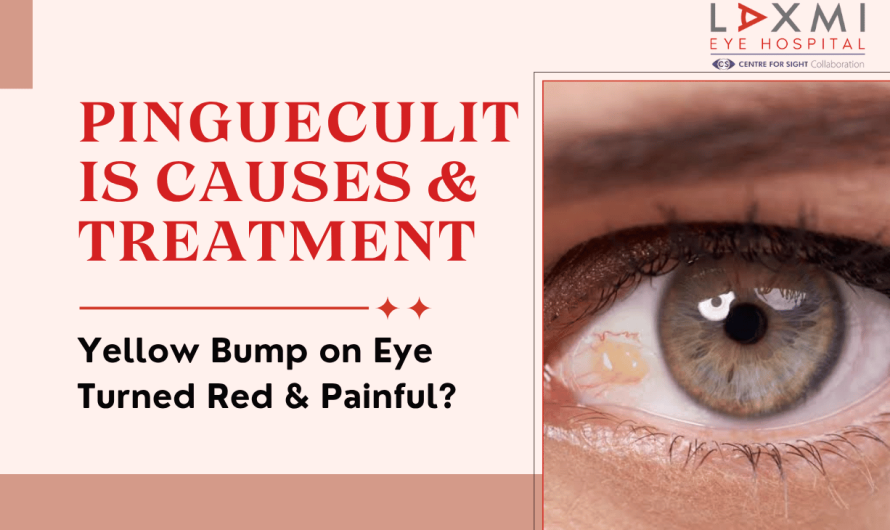 Yellow Bump on Eye Turned Red & Painful? Pingueculitis Causes & Treatment