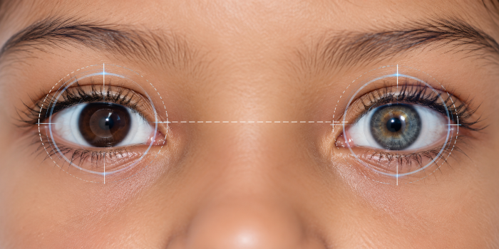 Anisometropia Treatment in Mumbai & Navi Mumbai at Laxmi Eye Hospital
