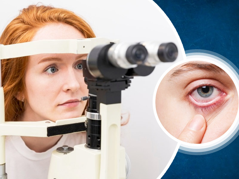 સામાન્ય કોર્નિયલ રોગો માટે શ્રેષ્ઠ આંખની સંભાળની સારવારનો અનુભવ કરો લક્ષ્મી આંખની હોસ્પિટલ, નવી મુંબઈમાં, પનવેલ, ખારઘર, કામોથે અને ડોમ્બિવલી ખાતે ના કેન્દ્રોમાં. 