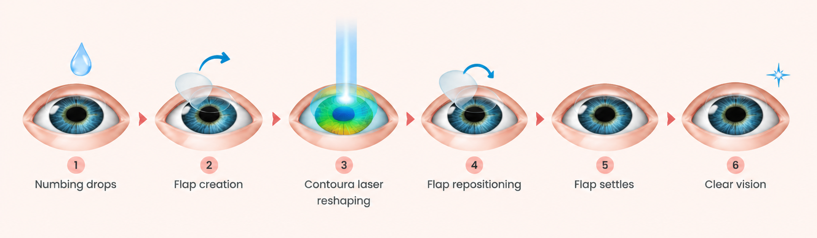 Contoura Vision LASIK Procedure at Laxmi Eye Institute and Hospitals located in Dombivli