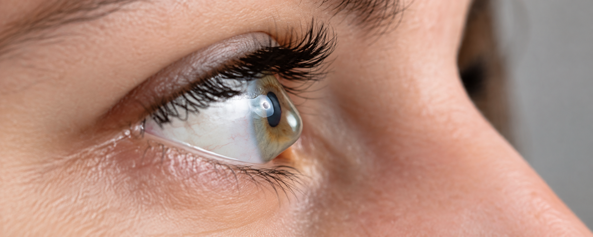 Keratoconus Treatment in Dombivli at Laxmi Eye Hospital
