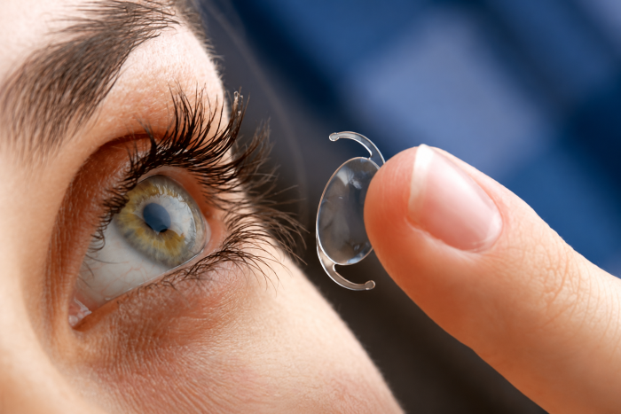 Cataract Treatment with Monofocal Lens