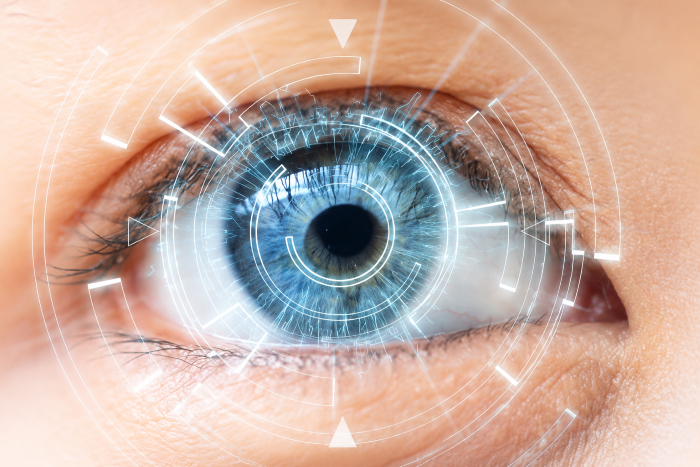 Multifocal Lens Implantation