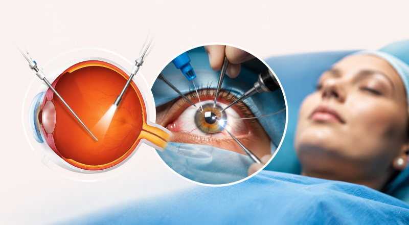 Retinal Technology